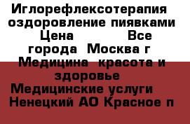 Иглорефлексотерапия, оздоровление пиявками › Цена ­ 3 000 - Все города, Москва г. Медицина, красота и здоровье » Медицинские услуги   . Ненецкий АО,Красное п.